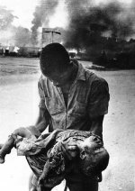 bnw-carlisle-umunna-nigeria-biafra-war-child-casualty-3.jpg